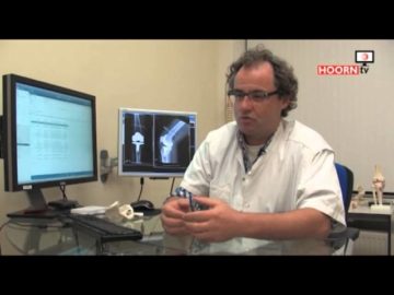 Nieuwe methode voor heupoperaties in het WFG